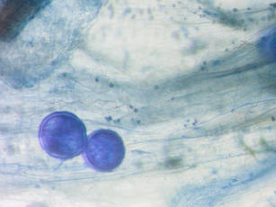 Imagem de Metodologia para criopreservação de esporos de fungos micorrízicos arbusculares